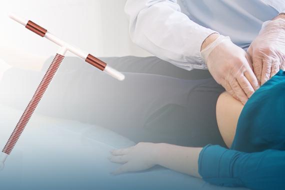 A doctor wearing gloves is examining a woman’s abdomen. The patient is lying down. On the left is a picture of an intrauterine device